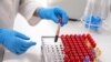 Kyrgyzstan -- Bishkek, November 19, 2018. Specialist working with blood tubes for analysis in a medical laboratory. Check the number of antibodies in the blood.